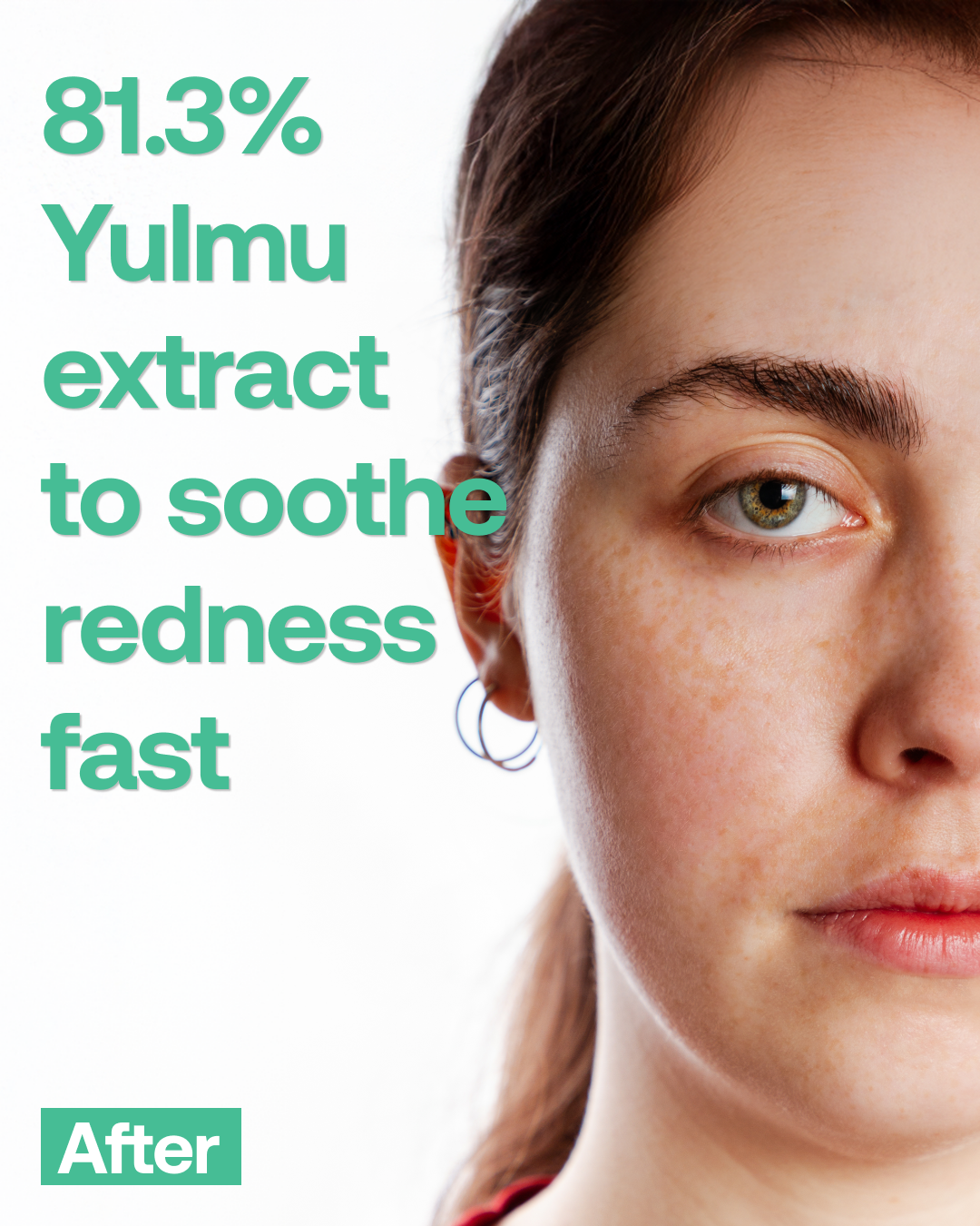 Phyto ac Infused Yulmu Trouble Serum 45ml (1.52 Fl Oz)
