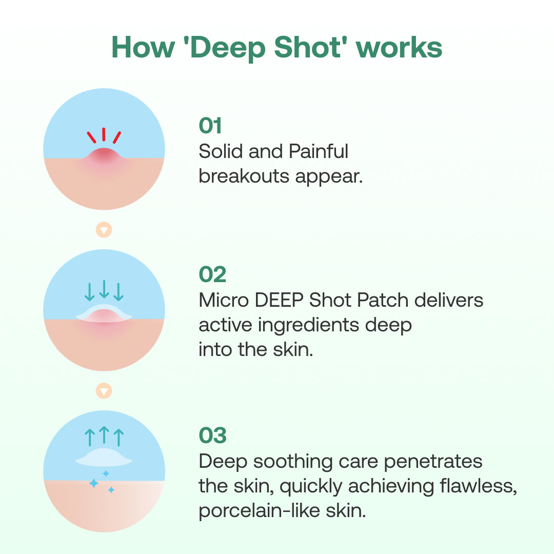 Yangyang Pine Quick Calming Spot Patch (12 Patches)